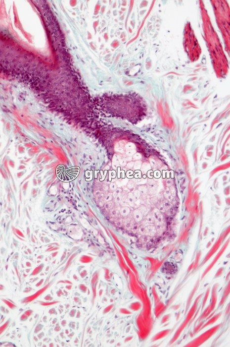 Glande sébacée x 40 - gryphea.com